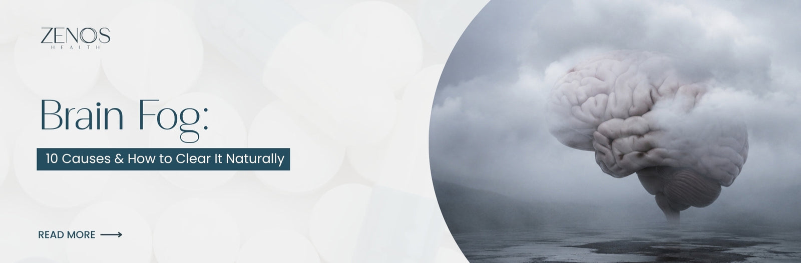 Brain Fog: 10 Causes and How to Clear It Naturally